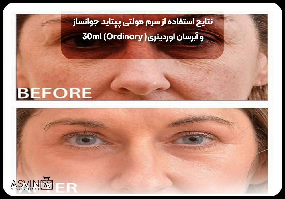 نتایج استفاده از سرم مولتی پپتاید جوانساز و آبرسان اوردینری (Ordinary) 30ml